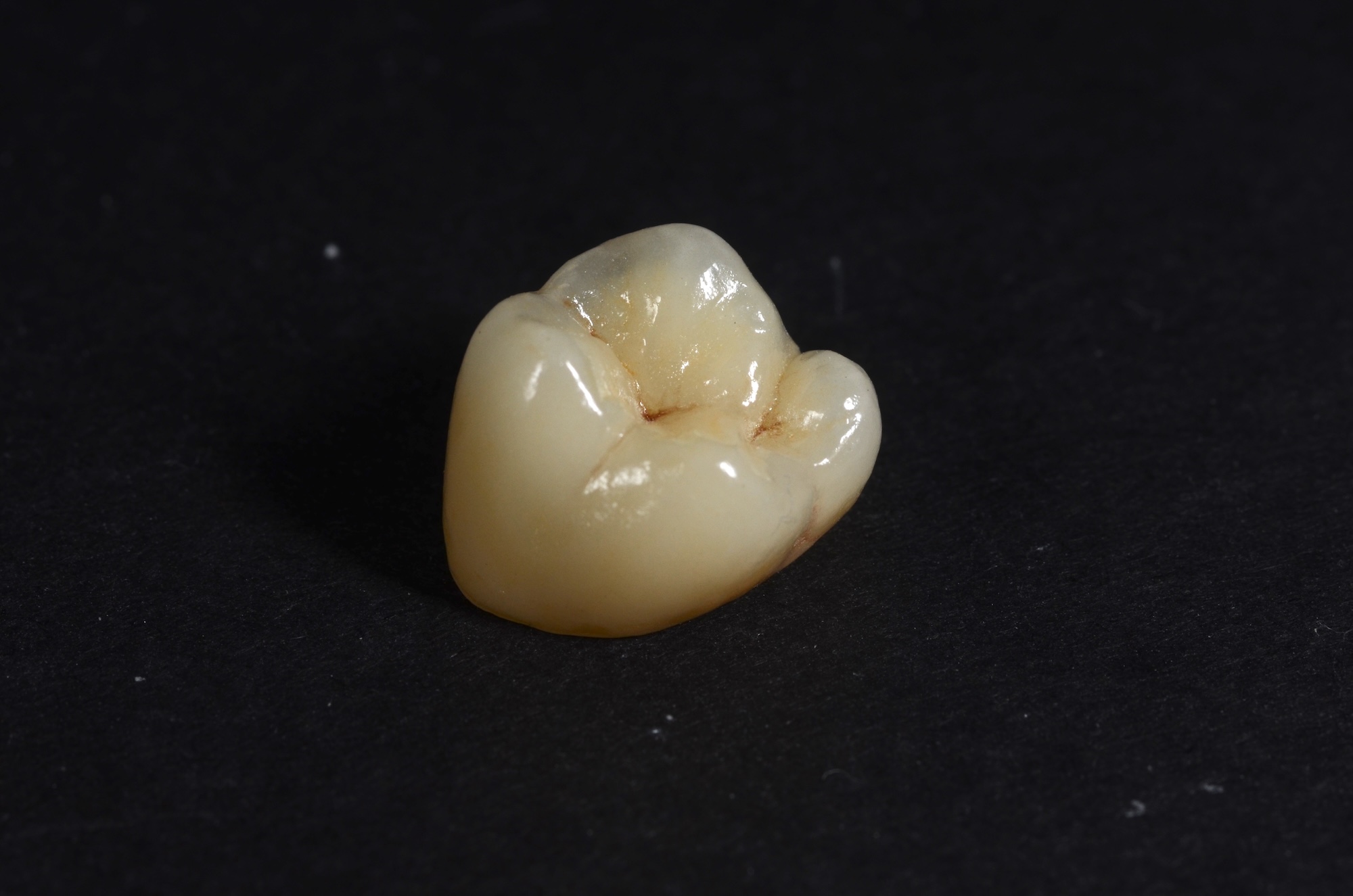 Full Contour Zirconia