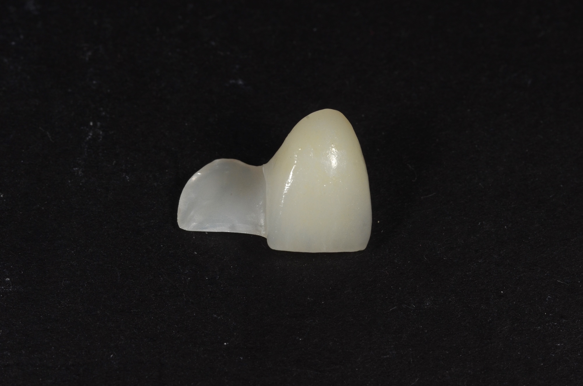 Full Contour Zirconia