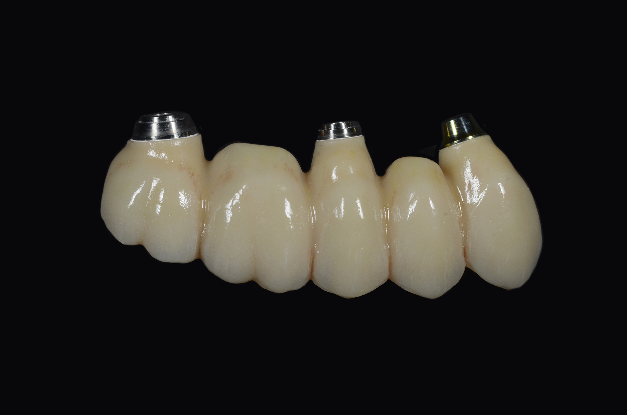 Full Zirconia / E.max