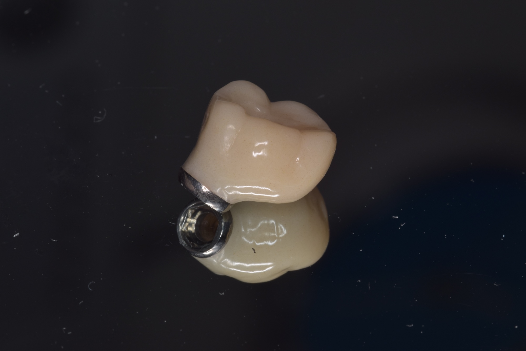 Full Zirconia / E.max